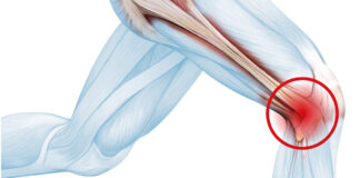 Running and IT Band Pain