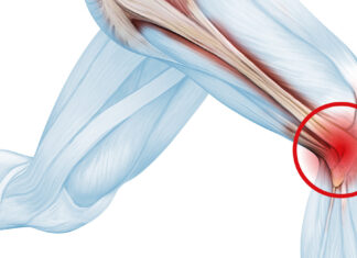 Running and IT Band Pain